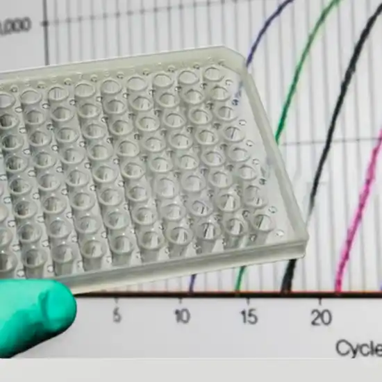 Real Time PCR for MTB Test